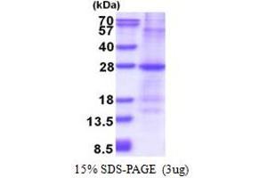 SDS-PAGE (SDS) image for Glutathione S-Transferase mu 1 (GSTM1) (AA 1-181) protein (His tag) (ABIN5853613) (GSTM1 Protein (AA 1-181) (His tag))