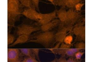 Immunofluorescence (IF) image for anti-Zinc Finger CCCH-Type Containing 7A (ZC3H7A) antibody (ABIN7256700)