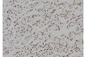 ABIN6279505 at 1/100 staining Human lung tissue by IHC-P. (TGIF2LX 抗体)