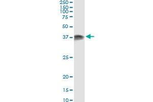 Immunoprecipitation (IP) image for anti-Protein Kinase, Interferon-Inducible Double Stranded RNA Dependent Activator (PRKRA) (AA 1-313) antibody (ABIN563706)