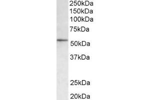 Western Blotting (WB) image for anti-Histone Deacetylase 1 (HDAC1) (AA 385-396) antibody (ABIN1101988) (HDAC1 抗体  (AA 385-396))