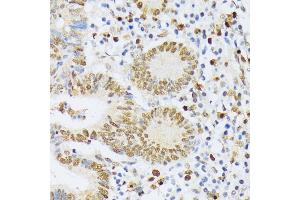 Immunohistochemistry (IHC) image for anti-ElaC Homolog 2 (ELAC2) (AA 1-270) antibody (ABIN6140108)