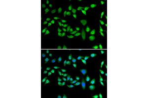 Immunofluorescence analysis of U2OS cells using DNAJB6 antibody. (DNAJB6 抗体)