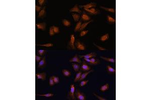 Immunofluorescence analysis of U-2 OS cells using PDE6D Polyclonal Antibody (ABIN7269303) at dilution of 1:100 (40x lens). (PDE6D 抗体  (AA 1-150))