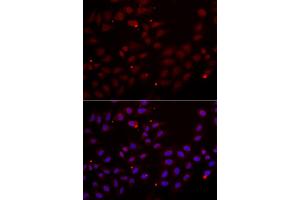 Immunofluorescence analysis of HeLa cells using CST2 antibody. (CST2 抗体)