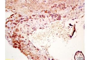 Formalin-fixed and paraffin embedded human placenta labeled with Anti-IL-7 Polyclonal Antibody, Unconjugated (ABIN734783) at 1:200 followed by conjugation to the secondary antibody and DAB staining (IL-7 抗体  (AA 51-154))