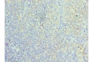 Immunohistochemistry of paraffin-embedded human tonsil tissue using ABIN7155295 at dilution of 1:100 (ASF1A 抗体  (AA 1-204))