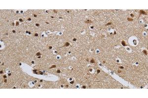 Immunohistochemistry of paraffin-embedded Human brain tissue using CMTM8 Polyclonal Antibody at dilution 1:40 (CMTM8 抗体)