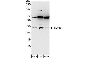 Western Blotting (WB) image for anti-Coatomer Protein Complex, Subunit epsilon (COPE) (AA 1-50) antibody (ABIN7453261)