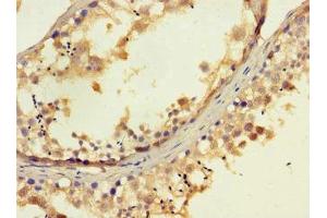 Immunohistochemistry of paraffin-embedded human testis tissue using ABIN7152269 at dilution of 1:100 (EXD2 抗体  (AA 137-245))