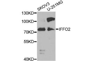 Western blot analysis of extracts of various cell lines, using IFFO2 antibody (ABIN2563343) at 1:1000 dilution. (IFFO2 抗体)