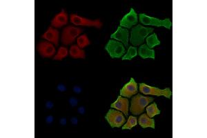 Phospho-RAB7L1 (Thr71) Antibody staining HepG2 cells(serum starvation treatment) by IF/ICC. (RAB7L1 抗体  (pThr71))