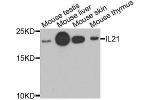 Western blot analysis of extracts of various cell lines, using IL21 antibody. (IL-21 抗体  (AA 25-162))