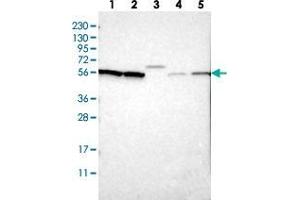 Western blot analysis of Lane 1: RT-4, Lane 2: U-251 MG, Lane 3: Human Plasma, Lane 4: Liver, Lane 5: Tonsil with SLC15A4 polyclonal antibody  at 1:250-1:500 dilution. (SLC15A4 抗体)