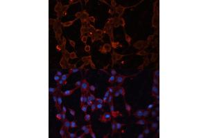 Immunofluorescence analysis of NIH/3T3 cells using SLC25 antibody (ABIN6132766, ABIN6147924, ABIN6147926 and ABIN6217967) at dilution of 1:100. (SLC25A27 抗体  (AA 1-245))