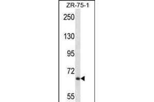JPH2 Antibody (C-term) (ABIN657368 and ABIN2846415) western blot analysis in ZR-75-1 cell line lysates (35 μg/lane). (Junctophilin 2 抗体  (C-Term))