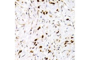 Immunohistochemistry (IHC) image for anti-Tumor Protein P53 (TP53) antibody (ABIN3017541) (p53 抗体)