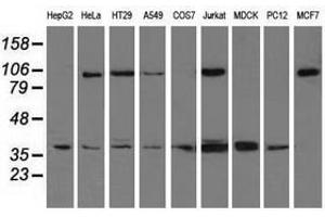 Image no. 2 for anti-X-Ray Repair Complementing Defective Repair in Chinese Hamster Cells 1 (XRCC1) antibody (ABIN1501770) (XRCC1 抗体)
