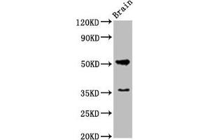 Western Blot Positive WB detected in: Rat brain tissue All lanes: Chrm1 antibody at 5. (CHRM1 抗体  (AA 210-366))