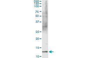 Immunoprecipitation of FABP1 transfected lysate using anti-FABP1 monoclonal antibody and Protein A Magnetic Bead , and immunoblotted with FABP1 MaxPab rabbit polyclonal antibody. (FABP1 抗体  (AA 1-127))
