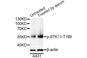 Western blot analysis of extracts of A431 cells, using Phospho-STK11-T189 antibody (ABIN5995630) at 1/1000 dilution. (LKB1 抗体  (pThr189))