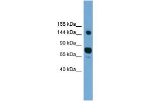 WB Suggested Anti-AGTPBP1 Antibody Titration: 0. (AGTPBP1 抗体  (N-Term))