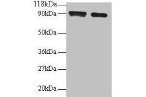 Western blot All lanes: SAT1 antibody at 2 μg/mL Lane 1: 293T whole cell lysate Lane 2: EC109 whole cell lysate Secondary Goat polyclonal to rabbit IgG at 1/15000 dilution Predicted band size: 21 kDa Observed band size: 90 kDa (SAT1 抗体  (AA 5-171))