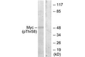 Western blot analysis of extracts from ovary cancer, using Myc (Phospho-Thr58) Antibody. (c-MYC 抗体  (pThr58))