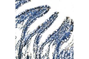 IHC analysis of splicing factor 1 using anti-splicing factor 1 antibody (ABIN7600193). (Splicing Factor 1 抗体  (AA 160-266))