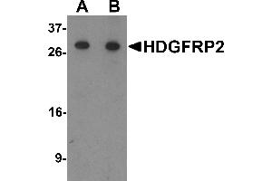 Western blot analysis of HDGFRP2 in human testis tissue lysate with HDGFRP2 antibody at (A) 0. (HDGFRP2 抗体  (N-Term))