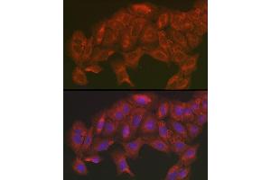 Immunofluorescence analysis of U2OS cells using [KO Validated] SOD2 Rabbit pAb (ABIN3021903, ABIN3021904, ABIN3021905 and ABIN6217382) at dilution of 1:200 (40x lens). (SOD2 抗体  (AA 25-222))