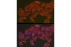 Immunofluorescence analysis of U2OS cells using [KO Validated] SOD2 Rabbit pAb (ABIN3021903, ABIN3021904, ABIN3021905 and ABIN6217382) at dilution of 1:200 (40x lens). (SOD2 抗体  (AA 25-222))