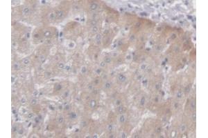 Detection of PCYOX1 in Human Liver Tissue using Polyclonal Antibody to Prenylcysteine Oxidase 1 (PCYOX1) (PCYOX1 抗体  (AA 174-505))