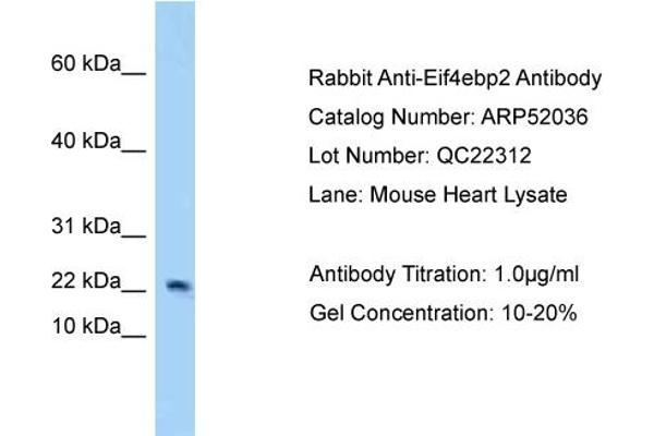 eIF4EBP2 抗体  (N-Term)