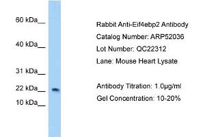 Western Blotting (WB) image for anti-Eukaryotic Translation Initiation Factor 4E Binding Protein 2 (EIF4EBP2) (N-Term) antibody (ABIN2784743) (eIF4EBP2 抗体  (N-Term))