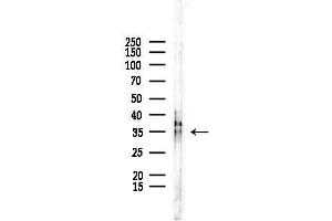 Western blot analysis of lysates from COLO205 cells, using SDCBP Antibody at 1/1000 dilution.