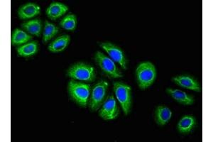 Immunofluorescence (IF) image for anti-Glial Fibrillary Acidic Protein (GFAP) (AA 292-432) antibody (ABIN7153847)