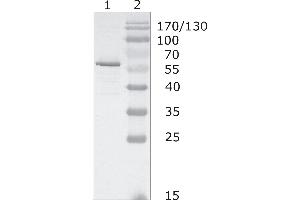 Western-Blot analysis of HIV-1 HAN subtype gag protein using HIV-1 p24 (05-001) antibody. (HIV-1 p24 抗体  (AA 48-62))
