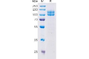 SDS-PAGE (SDS) image for Lymphocyte Antigen 9 (CD229) (AA 48-454) protein (Fc Tag) (ABIN7092668)