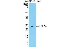 Western blot analysis of the recombinant protein. (FGF13 抗体  (AA 1-192))