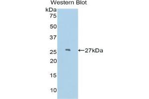 Detection of Recombinant PDCN, Mouse using Polyclonal Antibody to Podocin (PDCN) (Podocin 抗体  (AA 138-371))