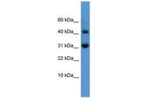 Image no. 1 for anti-Caspase 7, Apoptosis-Related Cysteine Peptidase (CASP7) (AA 107-156) antibody (ABIN6746543) (Caspase 7 抗体  (AA 107-156))