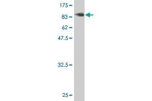 Western Blot detection against Immunogen (101. (LIMK2 抗体  (AA 1-686))
