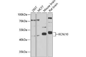 Western blot analysis of extracts of various cell lines, using KCNJ10 Antibody (ABIN6134092, ABIN6142719, ABIN6142720 and ABIN6225135) at 1:1000 dilution. (KCNJ10 抗体  (AA 50-150))