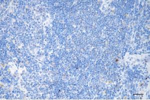 anti-Chromodomain Helicase DNA Binding Protein 3 (CHD3) antibody