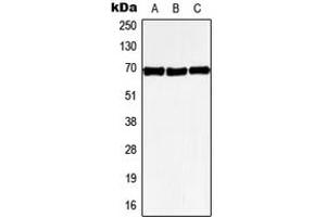 Western blot analysis of GPR50 expression in HeLa (A), SP2/0 (B), PC12 (C) whole cell lysates. (GPR50 抗体  (Center))
