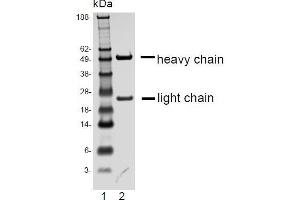 SDS-PAGE analysis of purified D6 monoclonal antibody. (FPR2 抗体)