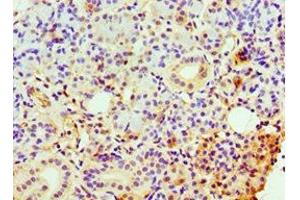 Immunohistochemistry of paraffin-embedded human pancreatic tissue using ABIN7147891 at dilution of 1:100 (CLDN14 抗体  (AA 140-239))