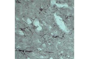 Immunohistochemistry (IHC) image for anti-Vacuolar Protein Sorting 45 (VPS45) antibody (ABIN351329)