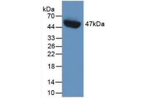 Detection of Recombinant PAI1, Human using Monoclonal Antibody to Plasminogen Activator Inhibitor 1 (PAI1) (PAI1 抗体)